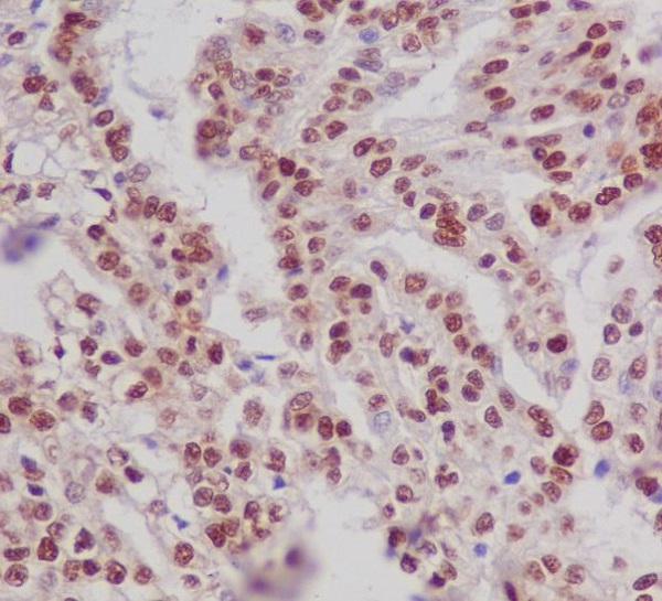 Phospho-Estrogen Receptor alpha (Ser118) Rabbit mAb